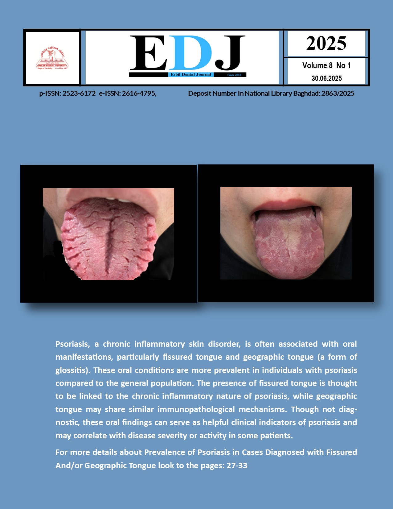 View Vol. 8 No. 1 (2025): Erbil Dental Journal EDJ